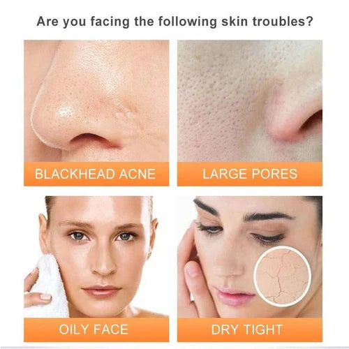 Dr. Rashel Vitamin C & Niacinamide Essence Cleansing Mousse, 120ml best quality face cleanser mousse best price in pakistan online 